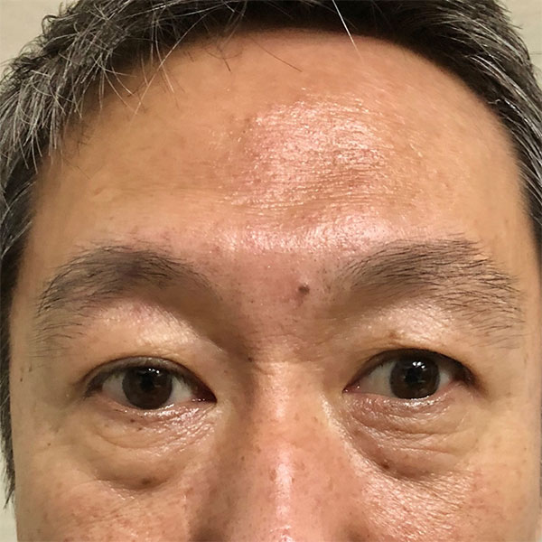 ビフォーアフター