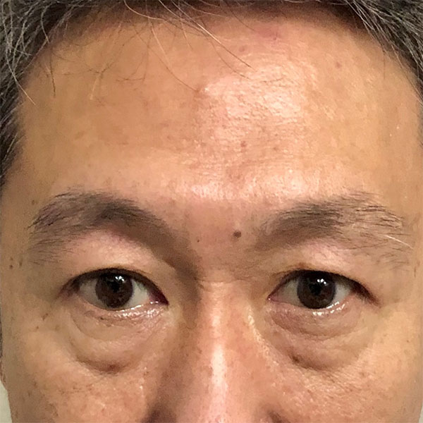 ビフォーアフター